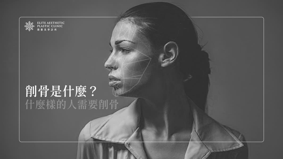 削骨恢復期-削骨是什麼